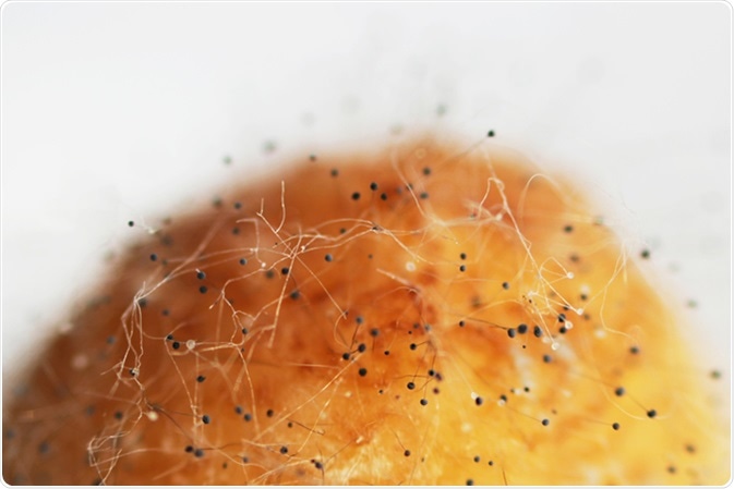 Aspergillosis Aspergillus flavus on a rotten banana on a white background. Image Credit: wolfness72 / Shutterstock